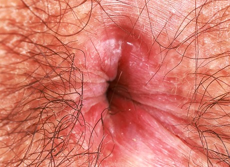 Hairy natural amateur peeling off jean skirt outdoors - 16 of 16