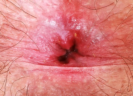 Redhead natural Gigi showing big juicy ass and hairy pussy - 16 of 16